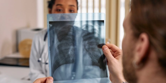 Geyve8217de-3.-Hekim-Hasta-Bulusmasi-Akciger-Hastaliklarini-Aydinlatti-featured
